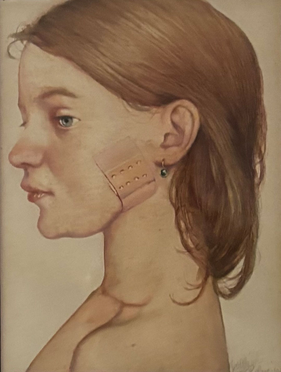 Das kleine Pflaster, Gottfried HELNWEIN